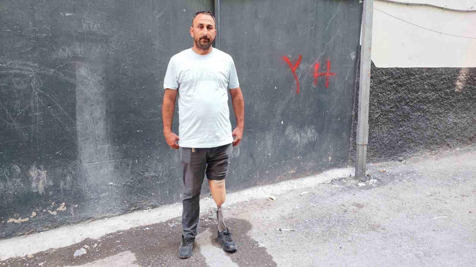 Protez Bacaklı Temizlik Görevlisi, 700 Lira Alacağı İçin İBAN Vererek İşini Kaybetti