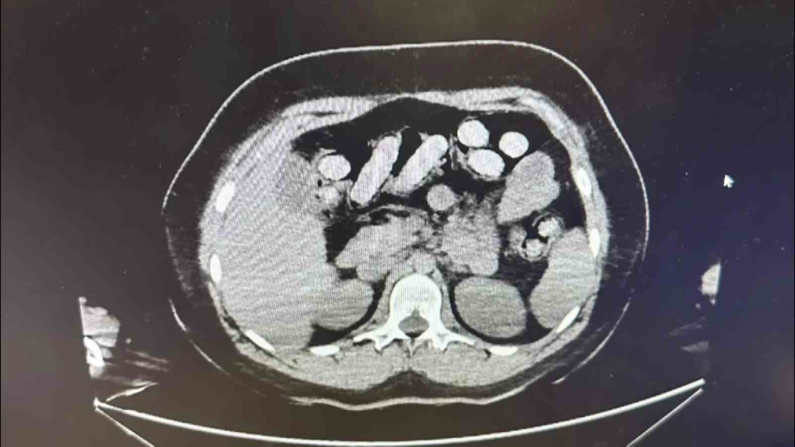 Adana'da Uyuşturucu Kuryeleri Yakalandı: 1.5 Kilo Metamfetamin Ele Geçirildi