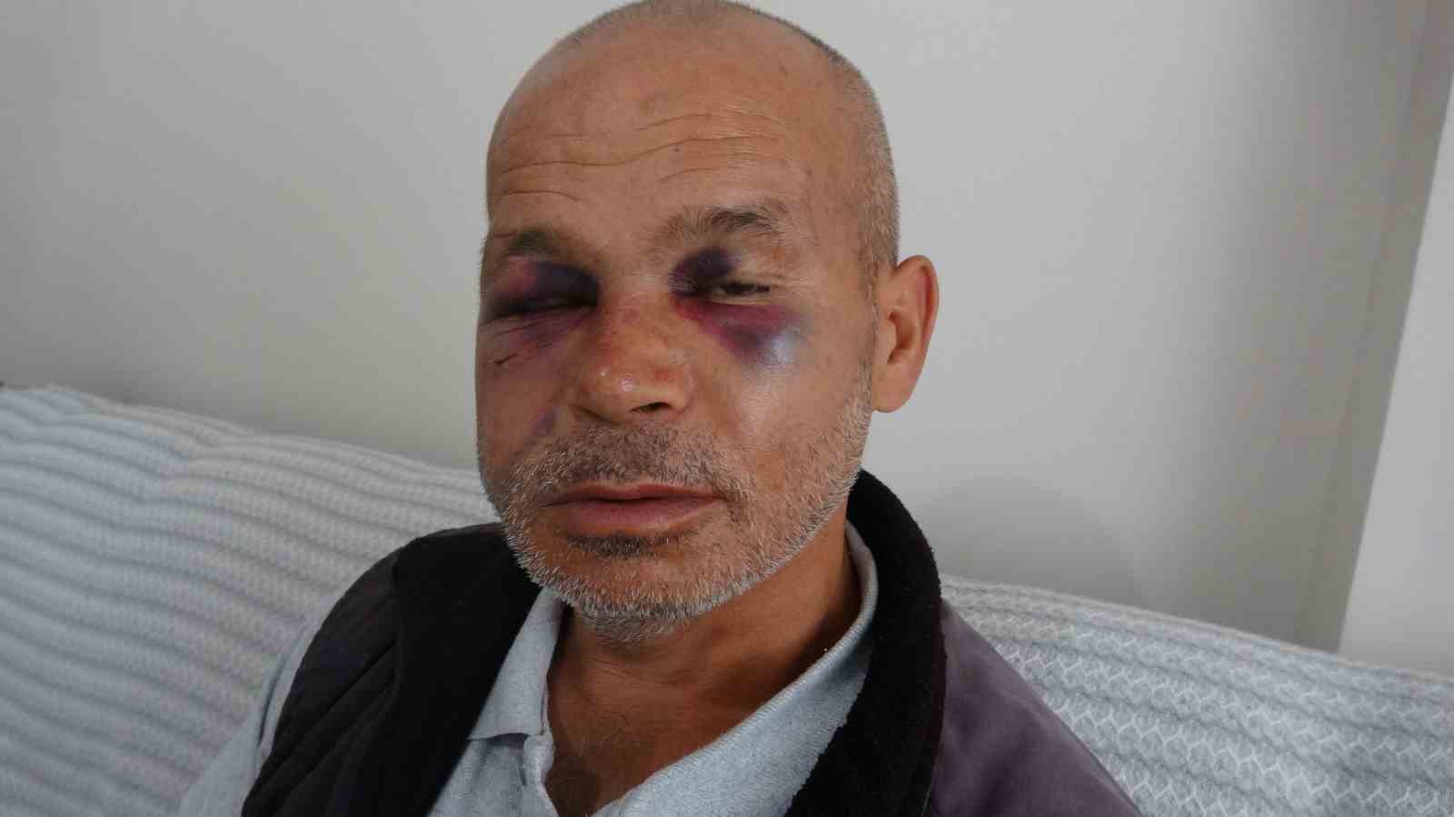Duyma ve Konuşma Engelli Adamın Darbedilmesi: Şüpheli Serbest Bırakıldı