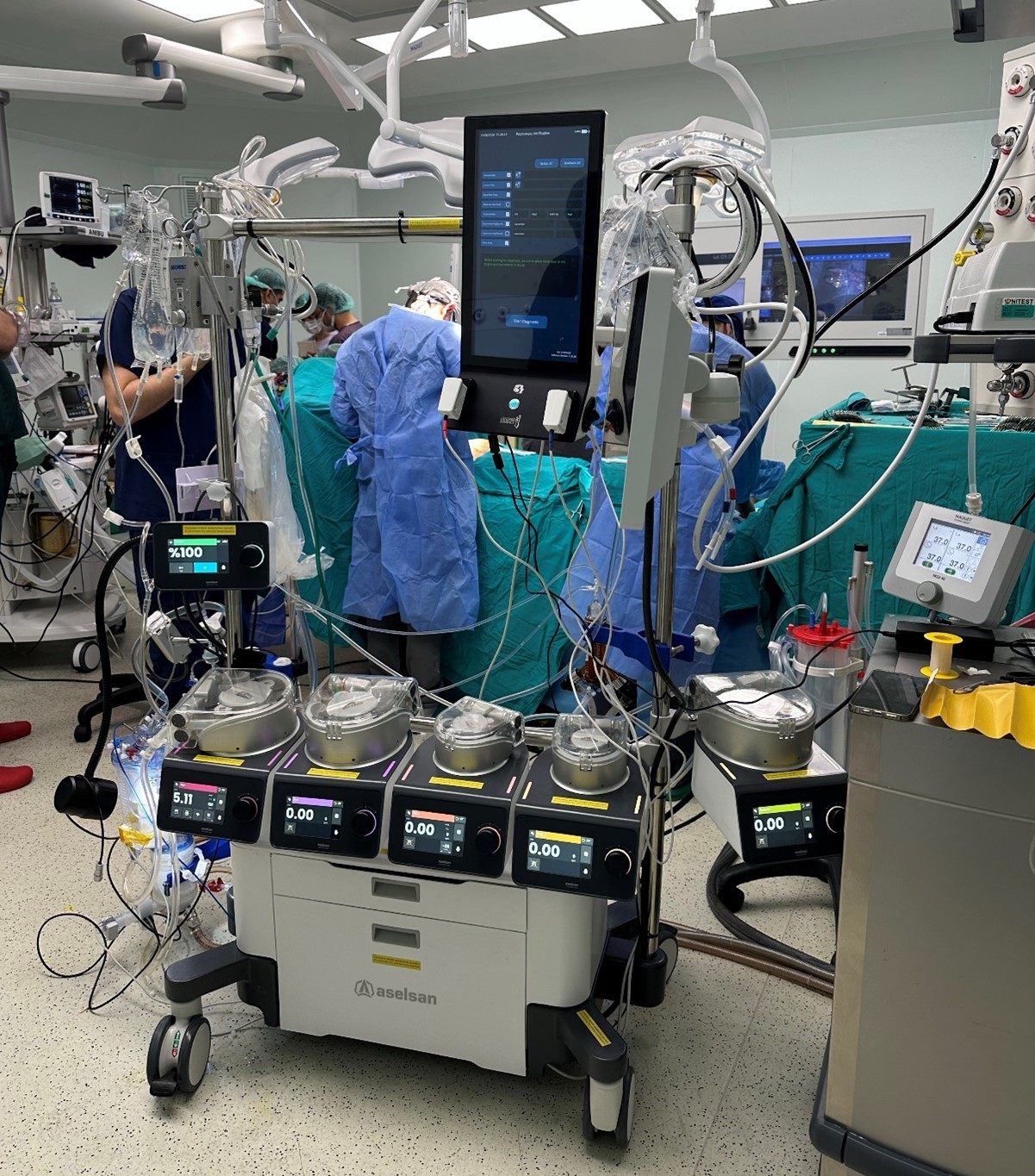 Yerli Kalp-Akciğer Makinesi LIFELINE HLM, 15 Ameliyatla Başarıya İmza Attı